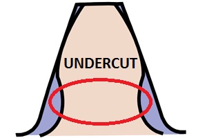 undercut