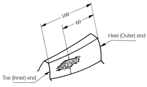 Mounting Accuracy Of Gears 